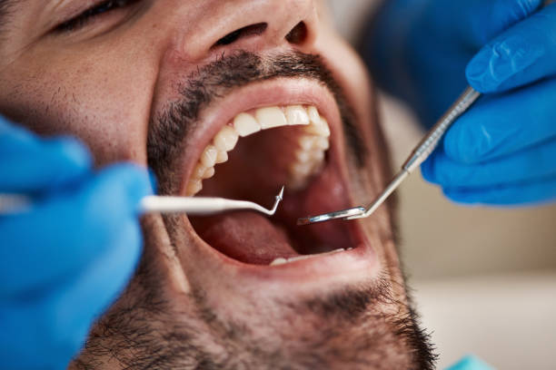 Best Emergency Tooth Extraction in St Pauls, NC